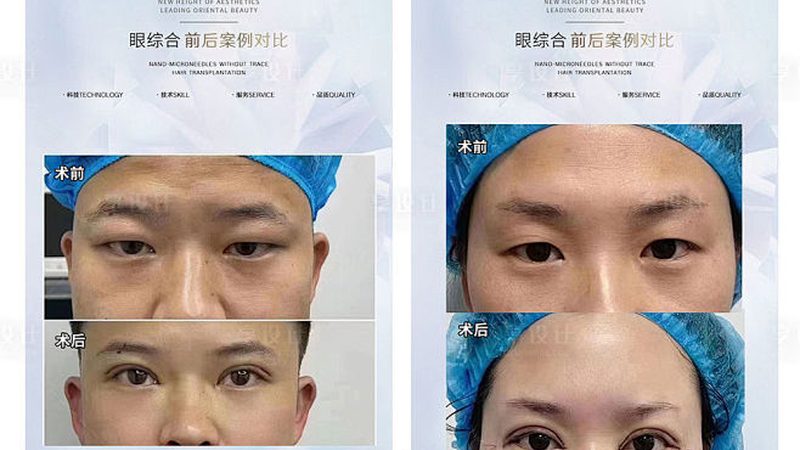 医美仪器OEM代加工：揭秘行业背后的技术秘密