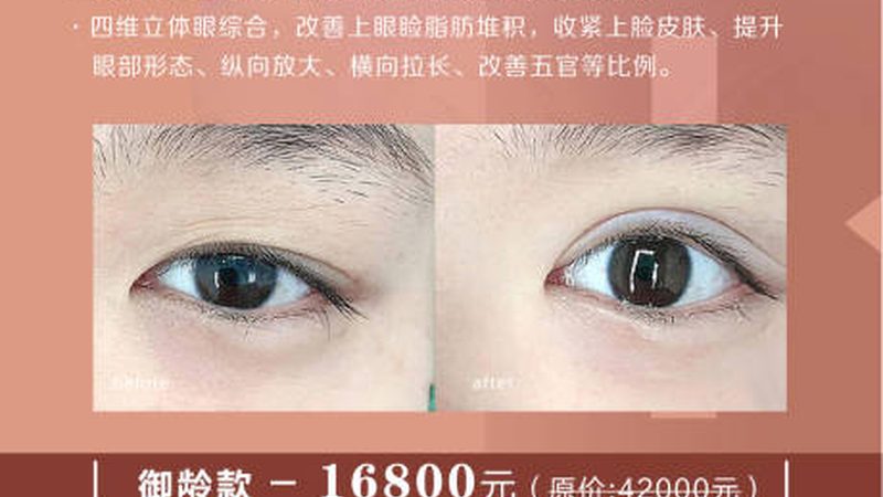皮肤管理仪器加盟店，定制报价背后的考量因素