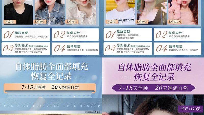 埋线提升：揭秘北京医院性价比高的秘密