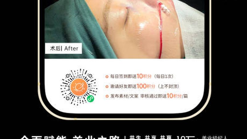 注射美容副作用不容忽视，真实案例揭秘风险与应对