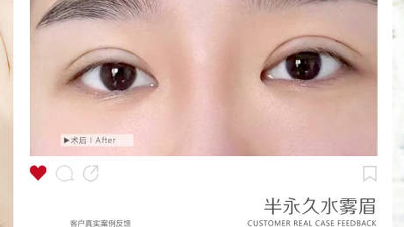瘦脸贴片：揭秘其效果持续时间的真相