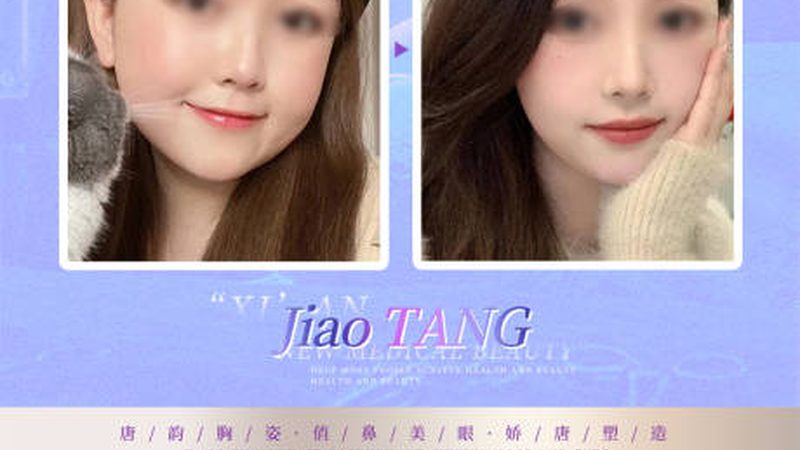 双眼皮修复，费用不只是数字游戏