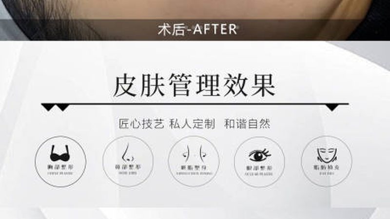 上海激光祛斑价格解析：揭秘影响费用的关键因素