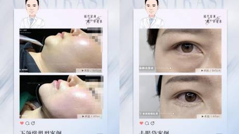 皮肤管理加盟，费用明细表背后的行业真相