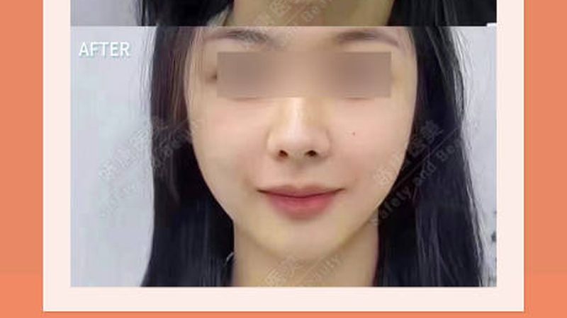 医美代理合作，揭秘合规流程步骤