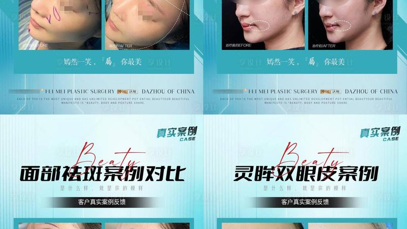 国产与进口注射美容针：揭秘两者间的差异与选择要点