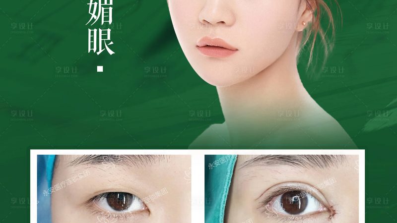 肉毒素价格背后的影响因素解析