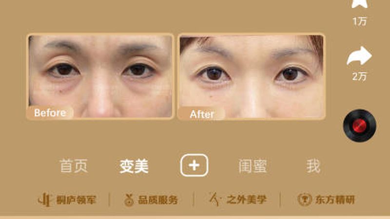 整形术后伤口感染处理：关键步骤与注意事项**