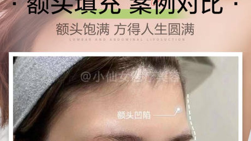 揭秘医美咨询师：三甲医院里的“美丽工程师